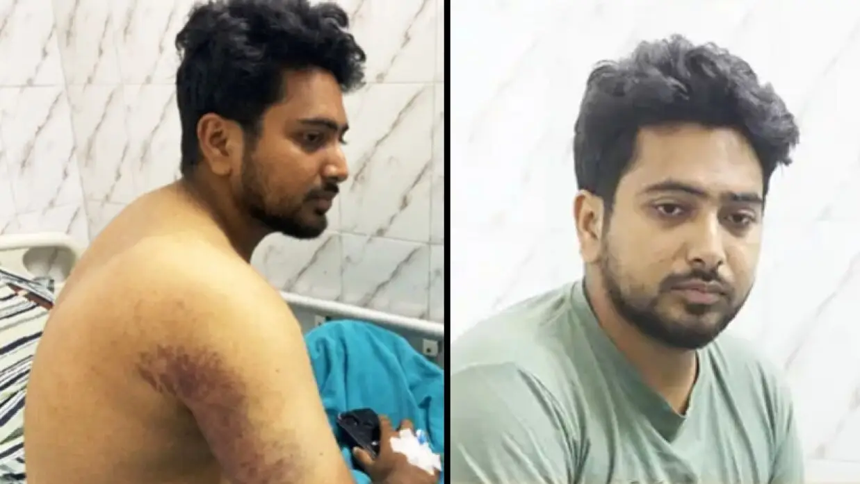 ২১ জুলাই: নির্যাতনের চিহ্ন নিয়ে সামনে আসেন সমন্বয়ক নাহিদ ইসলাম
