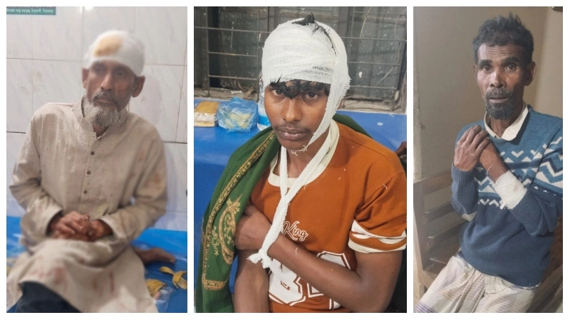 আওয়ামী লীগ নেতাদের হামলায় বিএনপির ৫ নেতাকর্মী আহত